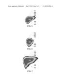 SYSTEMS, APPARATUS AND PROCESSES FOR AUTOMATED MEDICAL IMAGE SEGMENTATION USING A STATISTICAL MODEL diagram and image