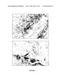 COMPOSITIONS AND METHODS FOR THE TREATMENT OF MUCORMYCOSIS AND OTHER FUNGAL DISEASES diagram and image