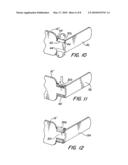 Dental bilatetal bite block diagram and image