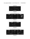 REGULATION OF CELL SURVIVAL BY HSP90 AND IP6K2 diagram and image