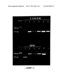 DISTINGUISHING PCA3 MESSENGER RNA SPECIES IN BENIGN AND MALIGNANT PROSTATE TISSUES diagram and image