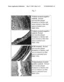 TREATMENT FOR AGE-RELATED MACULAR DEGENERATION AND OTHER DISEASES OF THE EYE diagram and image