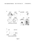 CNS GENE DELIVERY USING PERIPHERAL ADMINISTRATION OF AAV VECTORS diagram and image