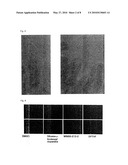 MEDICAMENT FOR PROPHYLACTIC AND THERAPEUTIC TREATMENT OF DERMATOSIS RESULTING FROM EXCESSIVELY ADVANCED KERATINIZATION diagram and image