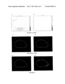 METHOD FOR REAL TIME TUMOUR VISUALISATION AND DEMARCATION BY MEANS OF PHOTODYNAMIC DIAGNOSIS diagram and image