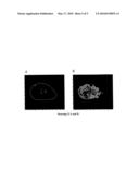 METHOD FOR REAL TIME TUMOUR VISUALISATION AND DEMARCATION BY MEANS OF PHOTODYNAMIC DIAGNOSIS diagram and image