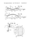 Apparatus for transportation of oxygen to implanted cells diagram and image