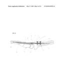 Intramedullary Arthrodesis Nail and Method of Use diagram and image