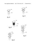 EXTRA DISCAL INTERVERTEBRAL STABILIZATION ELEMENT FOR ARTHRODESIS diagram and image