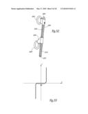 EXTRA DISCAL INTERVERTEBRAL STABILIZATION ELEMENT FOR ARTHRODESIS diagram and image