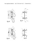 EXTRA DISCAL INTERVERTEBRAL STABILIZATION ELEMENT FOR ARTHRODESIS diagram and image