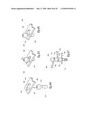 EXTRA DISCAL INTERVERTEBRAL STABILIZATION ELEMENT FOR ARTHRODESIS diagram and image