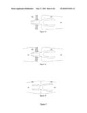 OSTEOSYNTHESIS DEVICE diagram and image