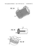 Endoluminal Implants For Bioactive Material Delivery diagram and image