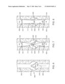 One-Way valve Prosthesis for Percutaneous Placement Within the Venous System diagram and image