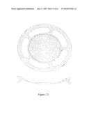 HAPTIC DEVICES FOR INTRAOCULAR LENS diagram and image