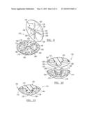 Porous Titanium Modular Revision Patella System diagram and image