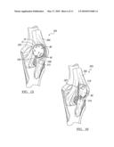 Porous Titanium Modular Revision Patella System diagram and image