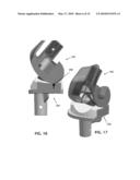 ANATOMICAL MOTION HINGED PROSTHESIS diagram and image