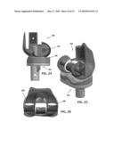 ANATOMICAL MOTION HINGED PROSTHESIS diagram and image