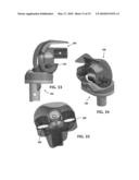 ANATOMICAL MOTION HINGED PROSTHESIS diagram and image