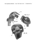 ANATOMICAL MOTION HINGED PROSTHESIS diagram and image