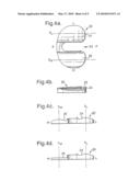 Tibial component diagram and image