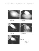 Methods and apparatus for image recognition and dictation diagram and image