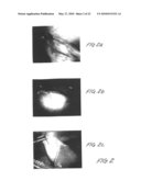 Methods and apparatus for image recognition and dictation diagram and image