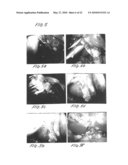 Methods and apparatus for image recognition and dictation diagram and image