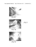 Methods and apparatus for image recognition and dictation diagram and image