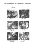 Methods and apparatus for image recognition and dictation diagram and image