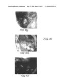 Methods and apparatus for image recognition and dictation diagram and image