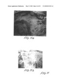 Methods and apparatus for image recognition and dictation diagram and image