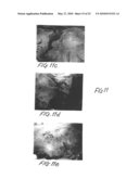 Methods and apparatus for image recognition and dictation diagram and image