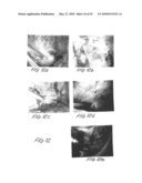 Methods and apparatus for image recognition and dictation diagram and image