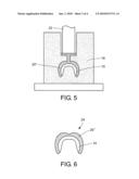 METHOD OF FORMING A DENTAL ARTICLE diagram and image