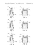 METHOD OF FORMING A DENTAL ARTICLE diagram and image