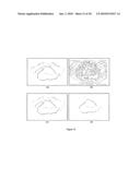 METHOD FOR AUTOMATIC BOUNDARY SEGMENTATION OF OBJECT IN 2D AND/OR 3D IMAGE diagram and image