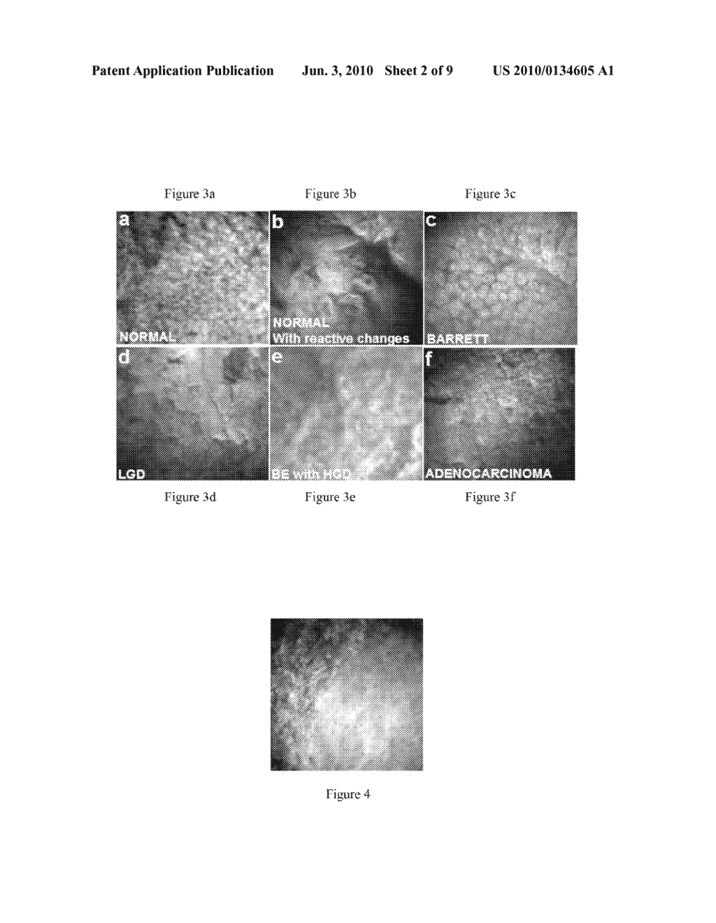 IN VIVO SPECTRAL MICRO-IMAGING OF TISSUE - diagram, schematic, and image 03