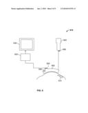 DIGITAL IMAGING SYSTEM FOR EYE PROCEDURES diagram and image