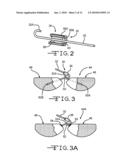 ELECTRICALLY CONNECTING MULTIPLE CATHODES IN A CASE NEGATIVE MULTI- ANODE CAPACITOR diagram and image