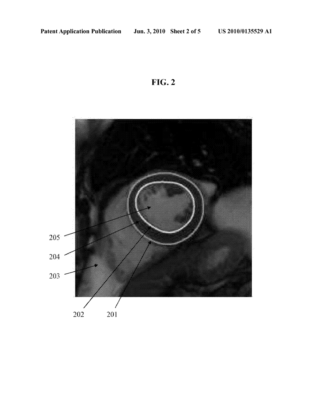 Systems and methods for tracking images - diagram, schematic, and image 03