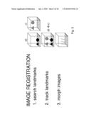 Method of registering images, algorithm for carrying out the method of registering images, a program for registering images using the said algorithm and a method of treating biomedical images to reduce imaging artefacts caused by object movement diagram and image