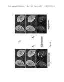 Method of registering images, algorithm for carrying out the method of registering images, a program for registering images using the said algorithm and a method of treating biomedical images to reduce imaging artefacts caused by object movement diagram and image