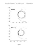 VERTEBRAL FRACTURE PREDICTION diagram and image