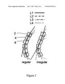 VERTEBRAL FRACTURE PREDICTION diagram and image