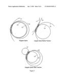 VERTEBRAL FRACTURE PREDICTION diagram and image