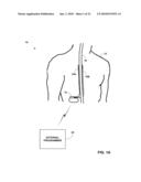 IMAGE-BASED CHARACTERIZATION OF IMPLANTED MEDICAL LEADS diagram and image