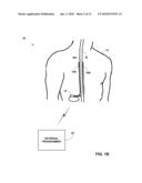 IMAGE-BASED CHARACTERIZATION OF IMPLANTED MEDICAL LEADS diagram and image
